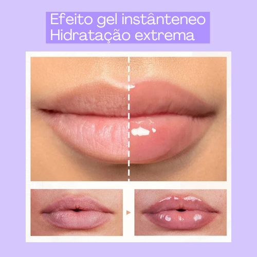 Plump Lip - Botox imediato