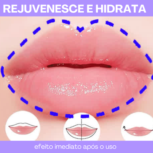 Plump Lip - Botox imediato